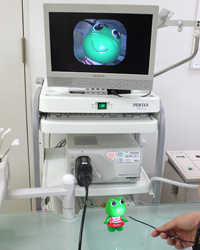 しもむら耳鼻咽喉科の内視鏡検査